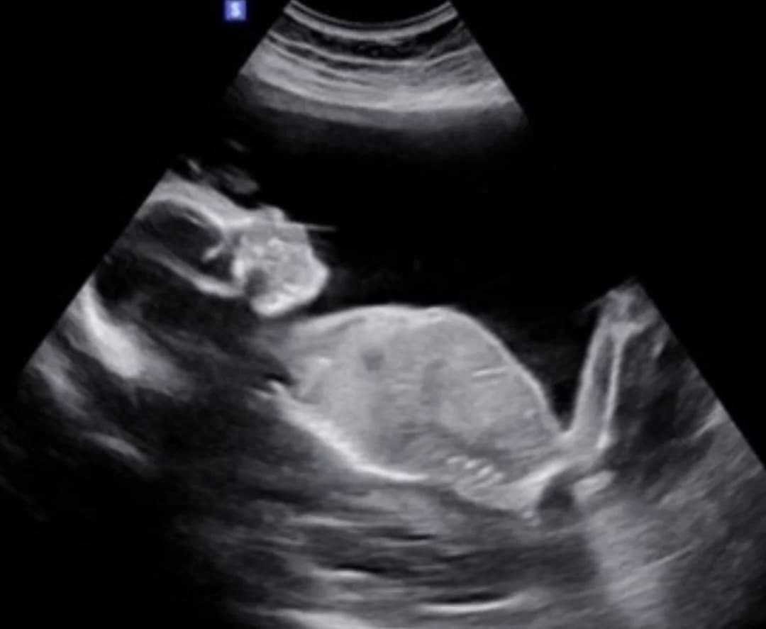 2D ultrasound session at 19 weeks pregnancy — Baby Studio 4D, Raleigh NC