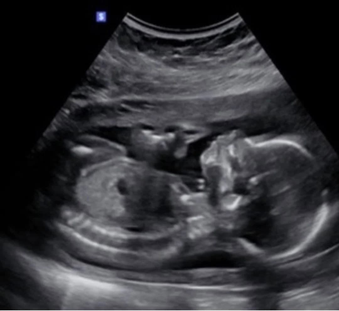 2D ultrasound session at 23 weeks pregnancy — Baby Studio 4D, Raleigh NC