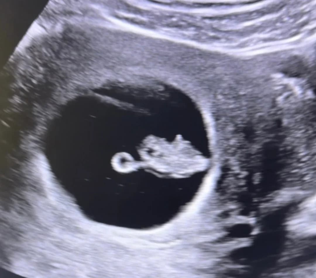 2D ultrasound session at 8 weeks pregnancy — Baby Studio 4D, Raleigh NC