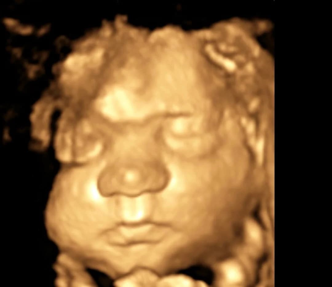 3D ultrasound session at 30 weeks pregnancy — Baby Studio 4D, Raleigh NC