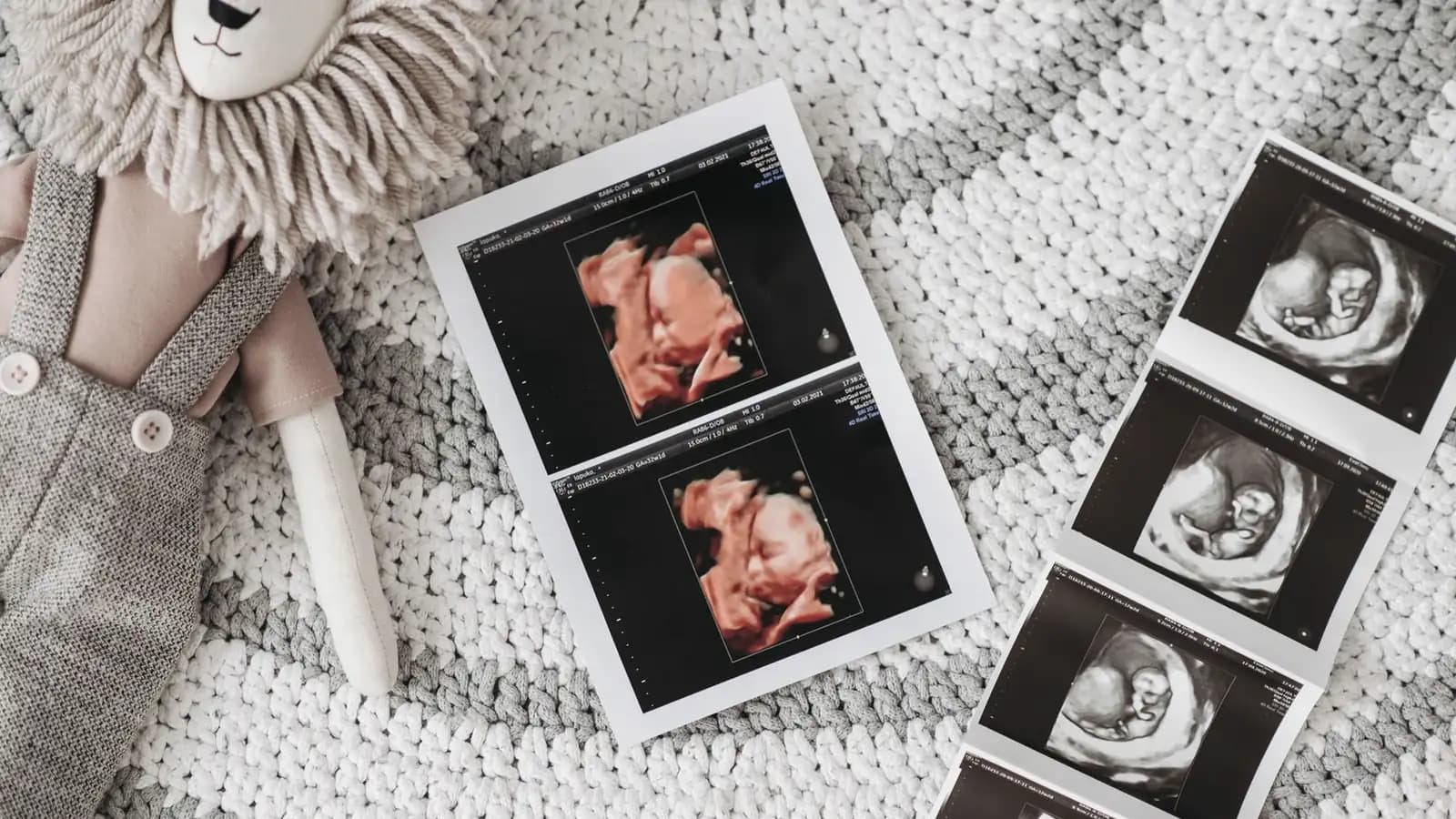 3D vs 4D ultrasound: 3D and 2D ultrasound prints on a soft knit blanket beside a plush lion