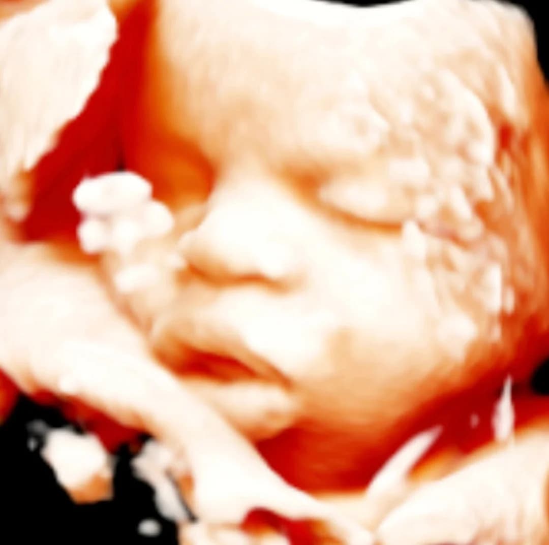 8K HD ultrasound session — Baby Studio 4D, Raleigh NC