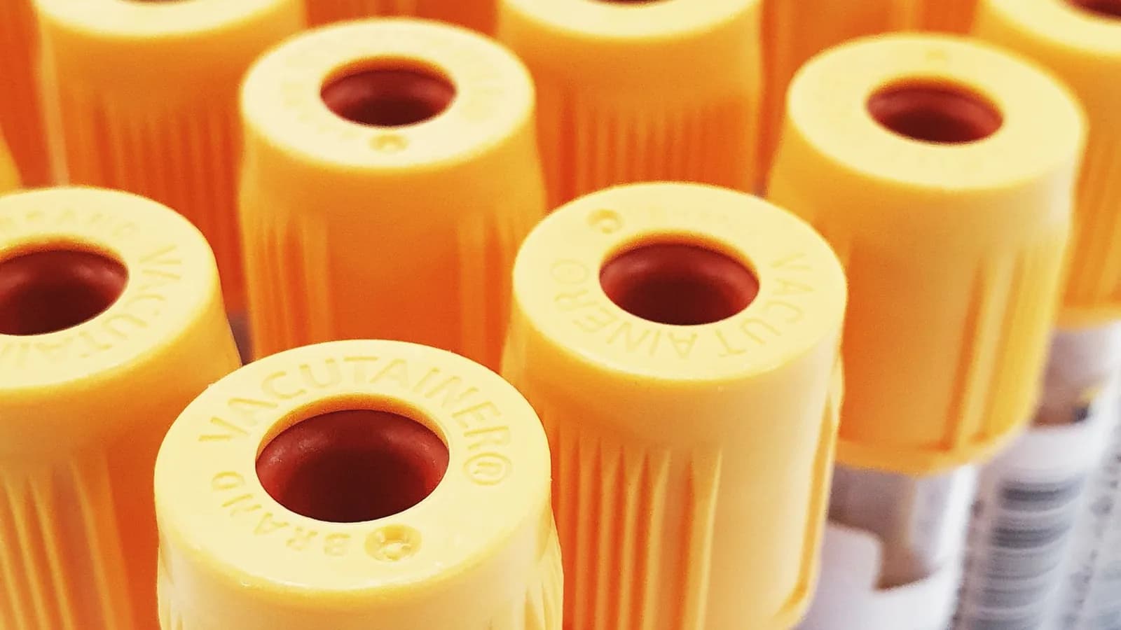 Early gender blood test: Rows of blood sample tubes with orange caps in a clean laboratory rack
