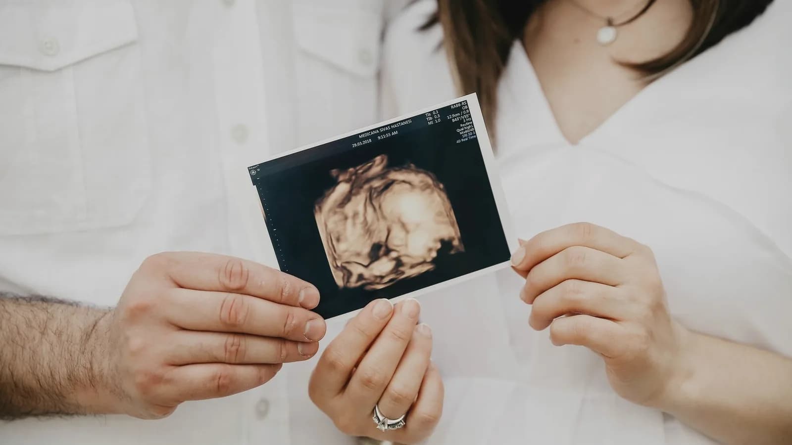 First ultrasound as a new dad: Couple in white holding a 3D ultrasound picture of their baby
