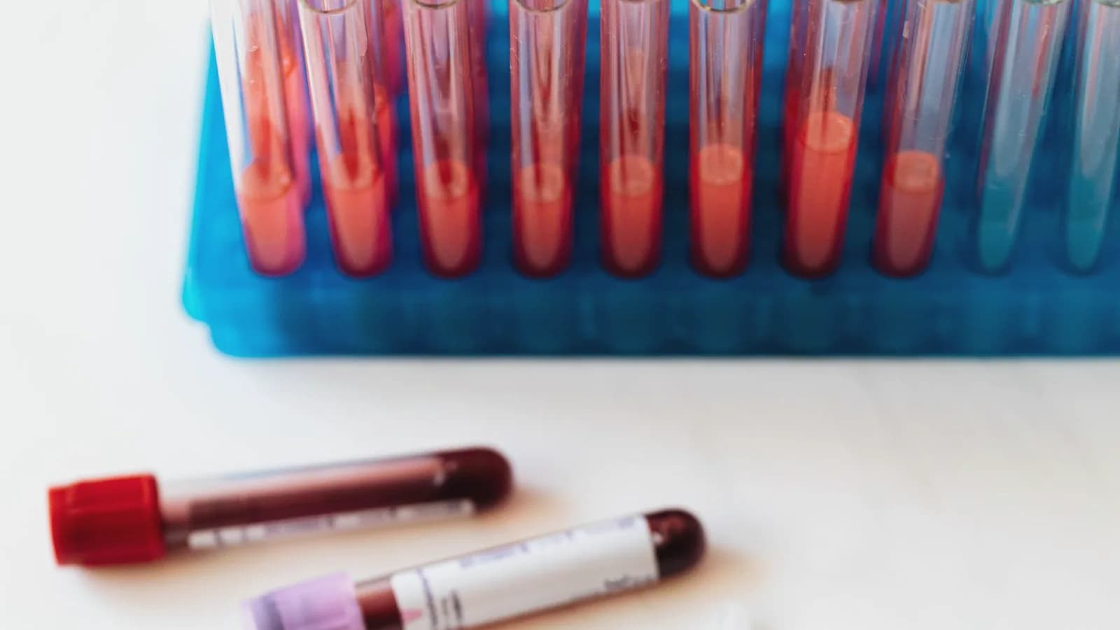 Gender blood test or ultrasound: Blood collection tubes and syringes laid out on a clean white surface