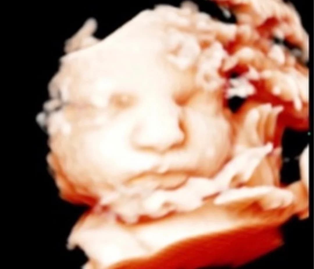 HD ultrasound session at 30 weeks pregnancy — Baby Studio 4D, Raleigh NC