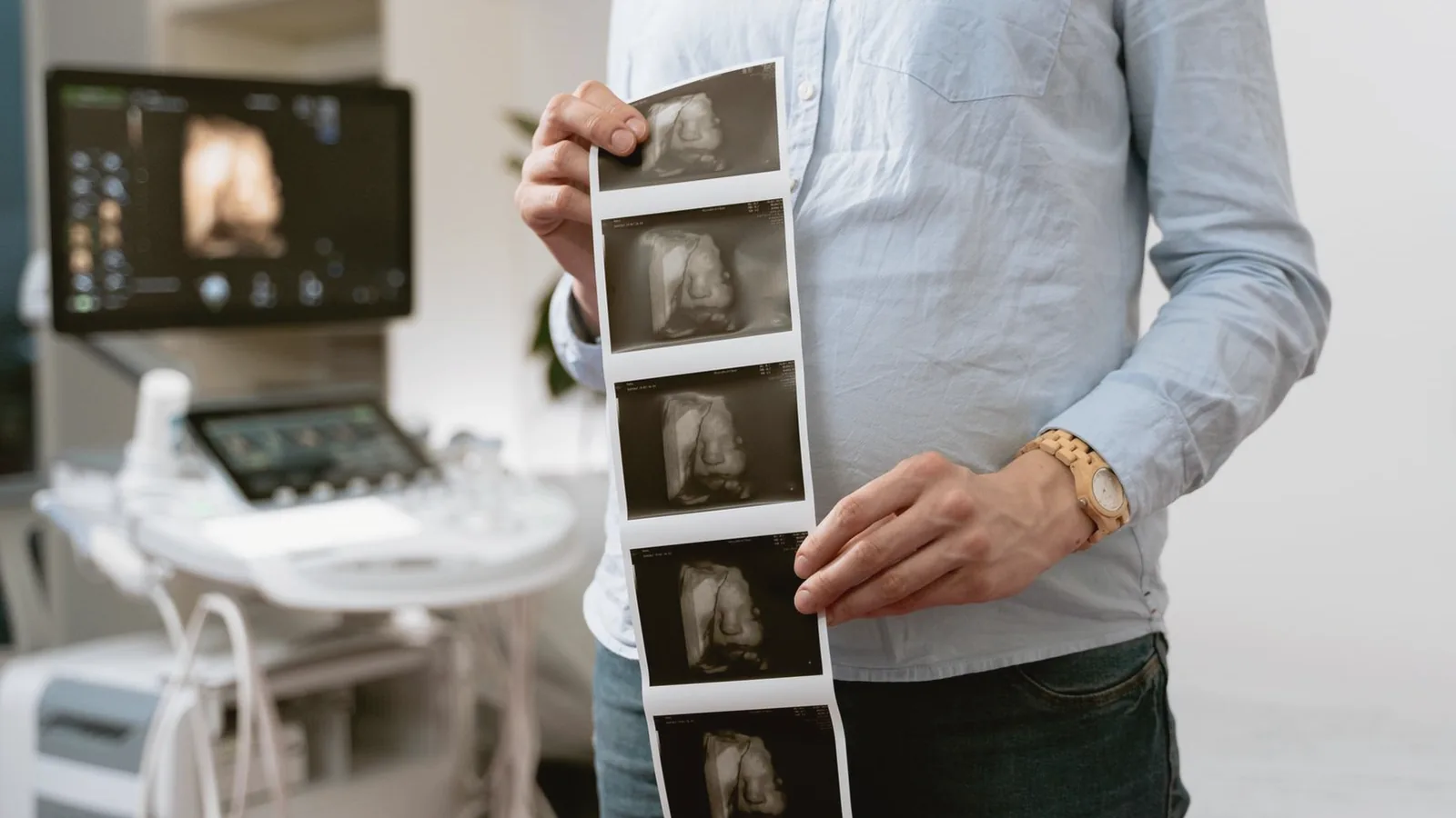 20 week anatomy scan: Expectant mother holding a strip of 3D ultrasound prints beside a scan machine