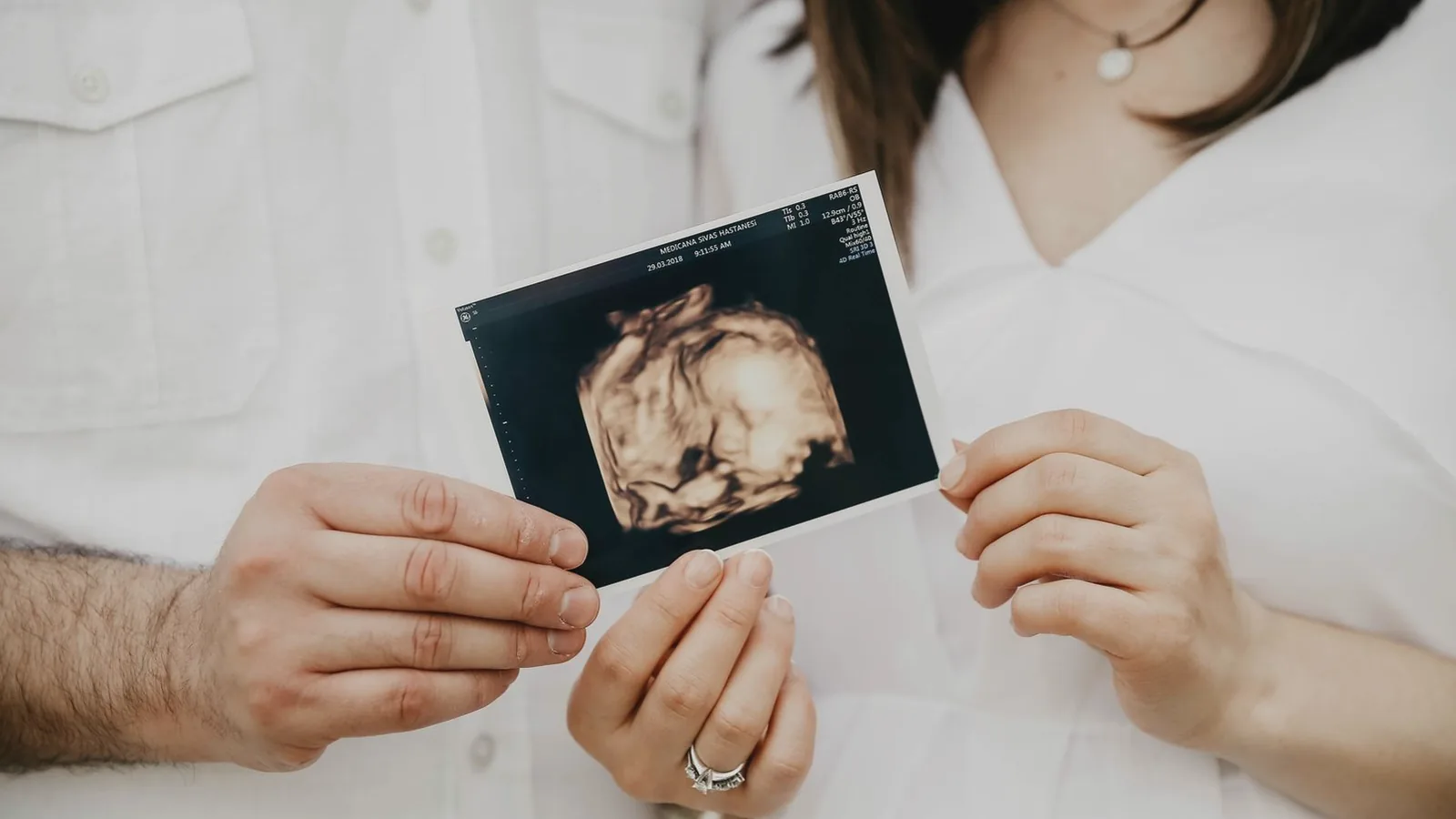 First ultrasound as a new dad: Couple in white holding a 3D ultrasound picture of their baby