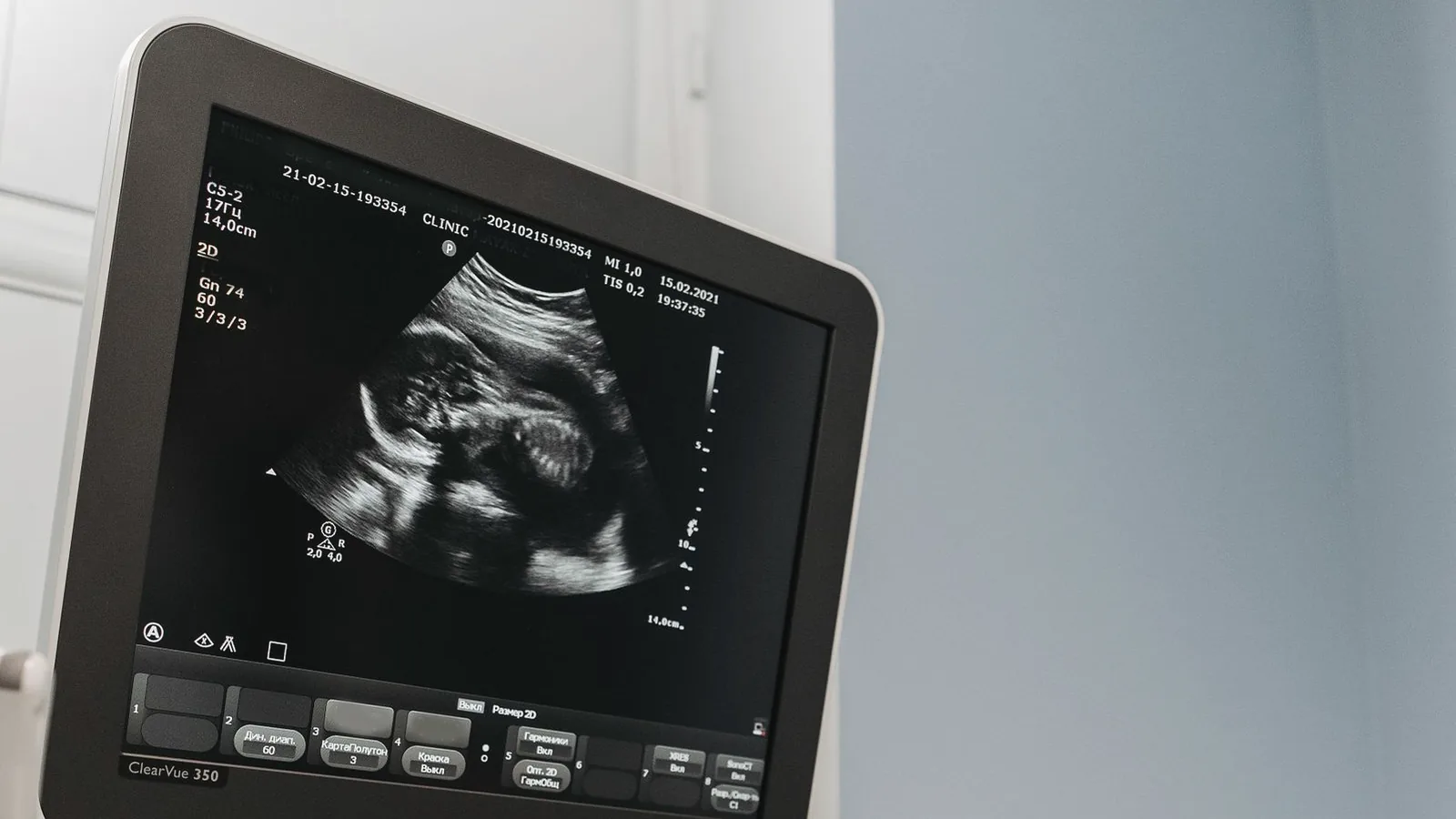 What is 8K ultrasound: Ultrasound machine screen displaying a detailed baby scan while a hand adjusts the controls