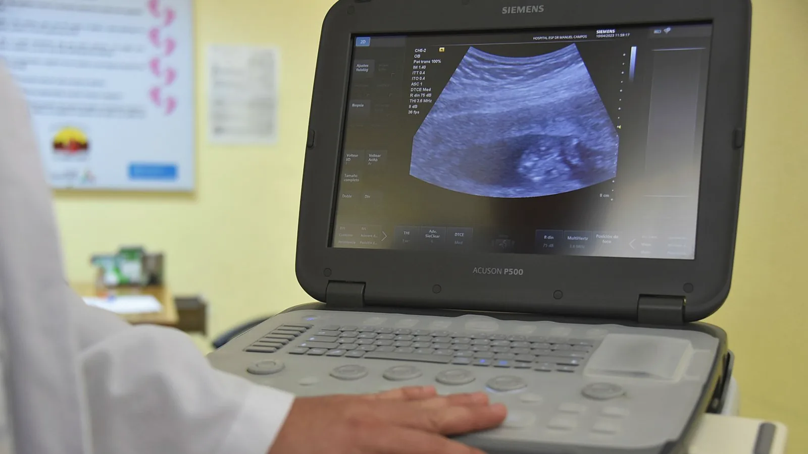 When can you find out baby gender: Portable ultrasound machine screen showing a baby scan during an appointment